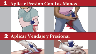 Stop the Bleed Poster (Spanish)